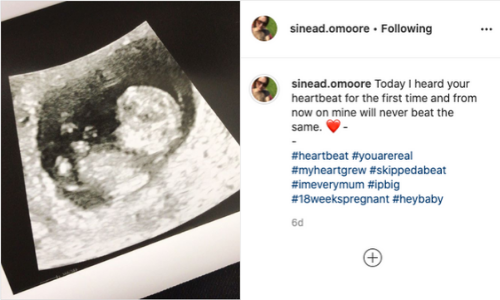 My Week 19 Pregnancy Diary: Don’t Be Afraid To Go To Your GP instagram